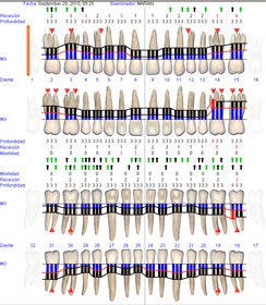 diagnóstico_de_la_enfermedad_periodontal diagnóstico_de_la_enfermedad_periodontal