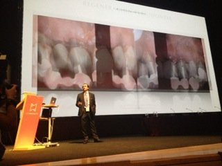 Beneficios de la cirugía regenerativa