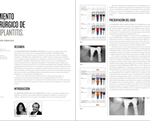 periodoncia