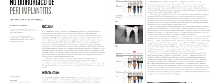 periodoncia