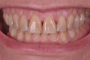 estética periodontal
