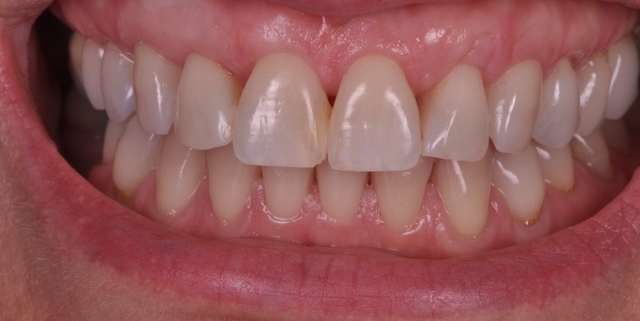 estética periodontal