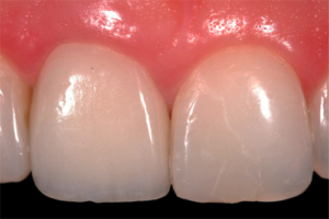 Periodoncia