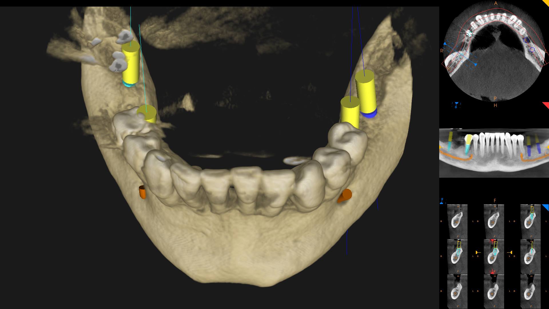 Qué son los CBCT