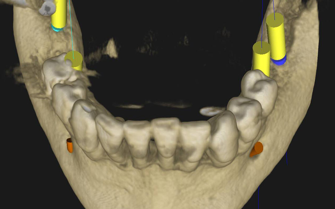 Qué son los CBCT