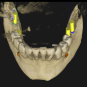 qué son los CBCT