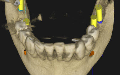 Qué son los CBCT