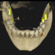 qué son los CBCT