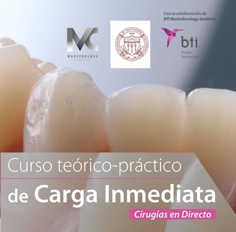 Curso Carga Inmediata