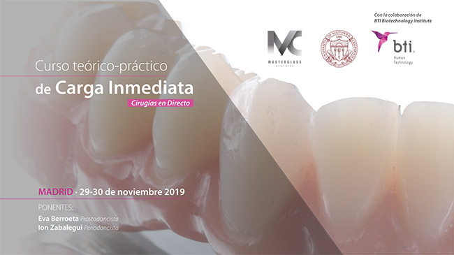 pdf curso carga inmediata