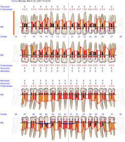 periodontograma