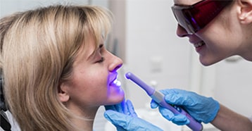 blanqueamiento clínica dental bilbao