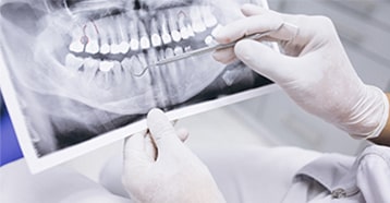 periodoncia clínica dental bilbao