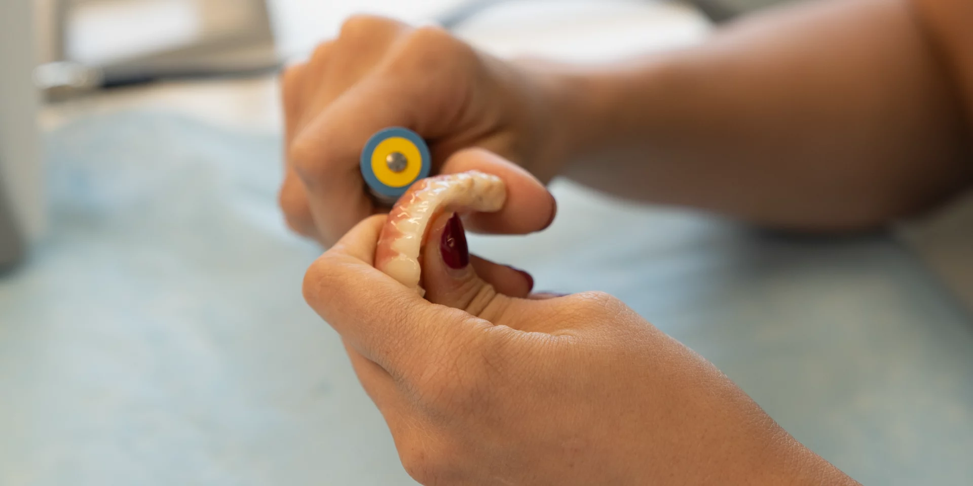 Implantes dentales de Carga inmediata