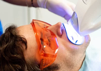 Tratamiento Blanqueamiento Clínica Dental