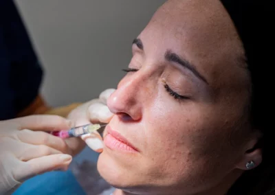 Labios Medicina Estética Zabalegui