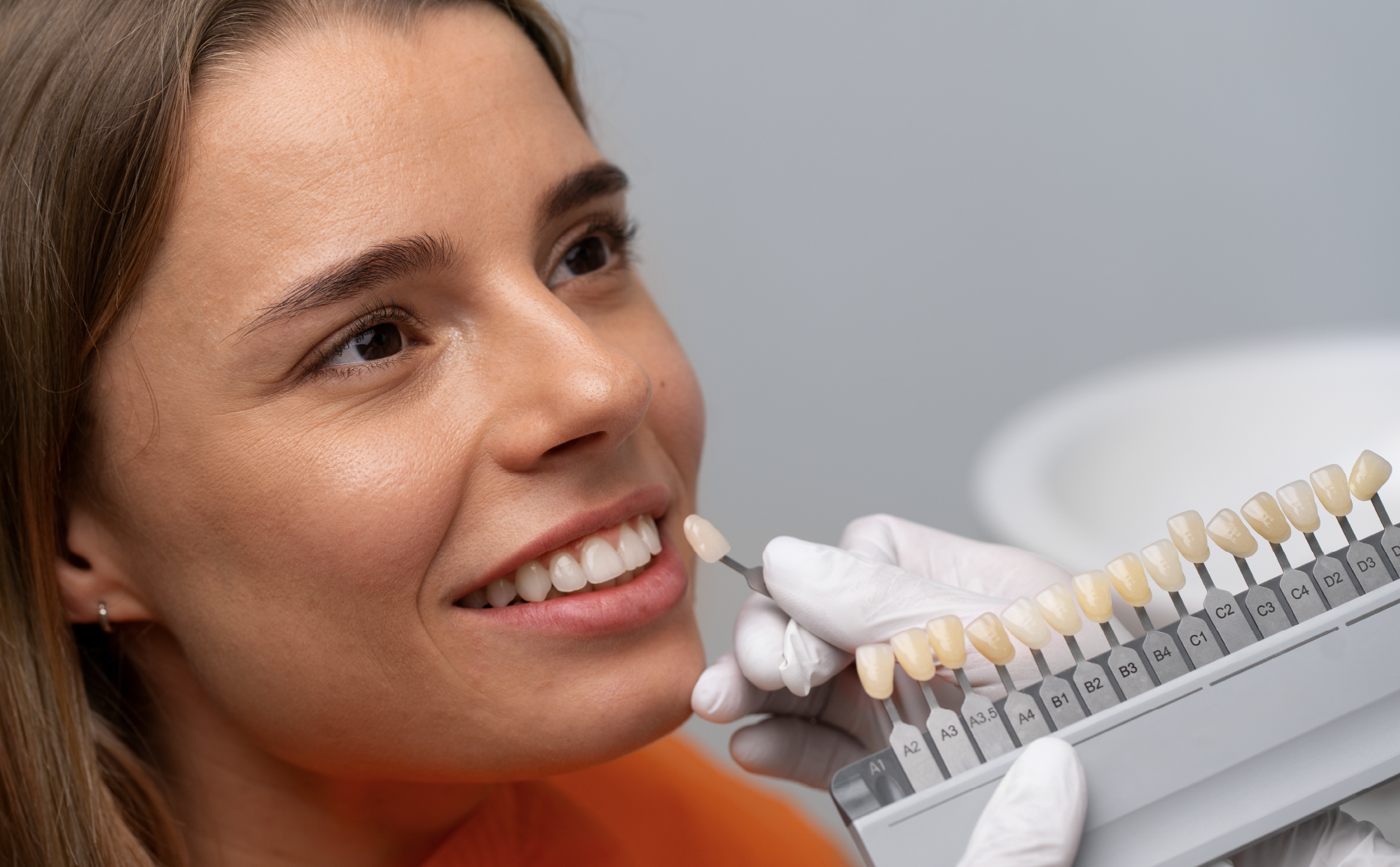 oghdslgn_Mesa de trabajo 1 Blanqueamiento dental Bilbao