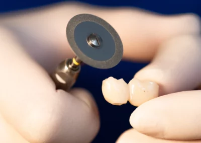 Estética Dental Zabalegui Bilbao