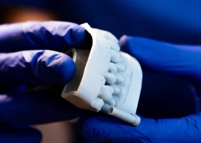 Moldes dentales Zabalegui