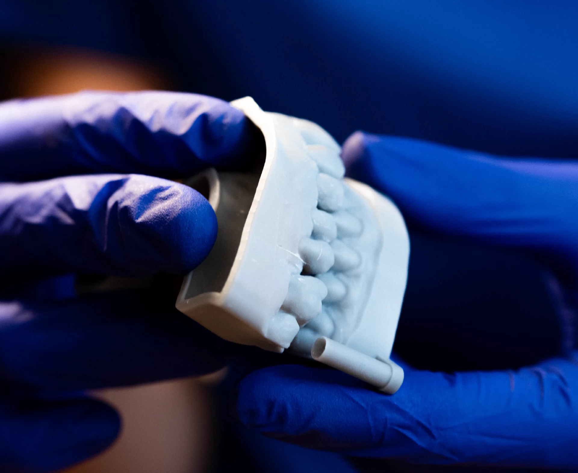 Moldes dentales Zabalegui