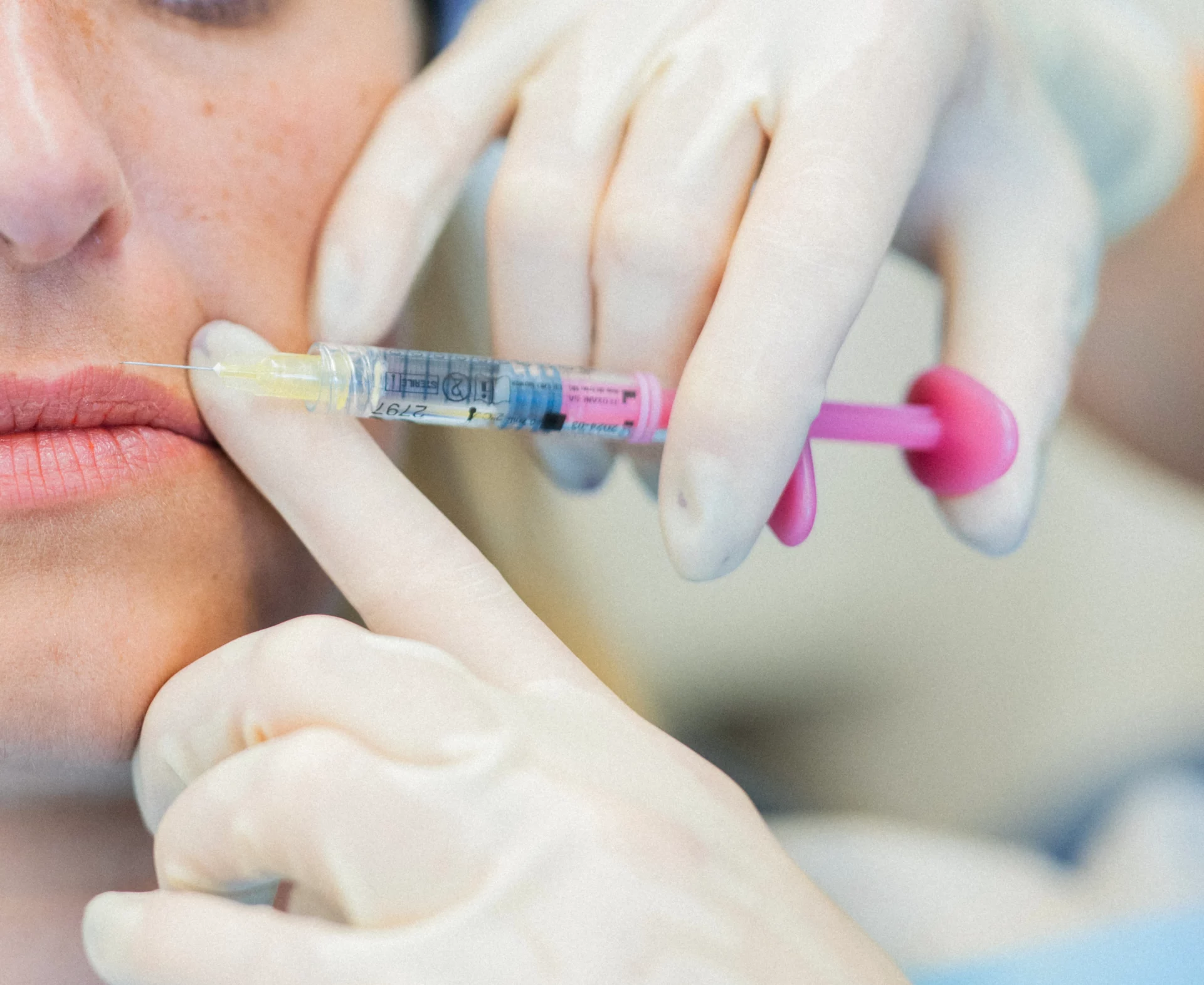 Labios Estética Zabalegui