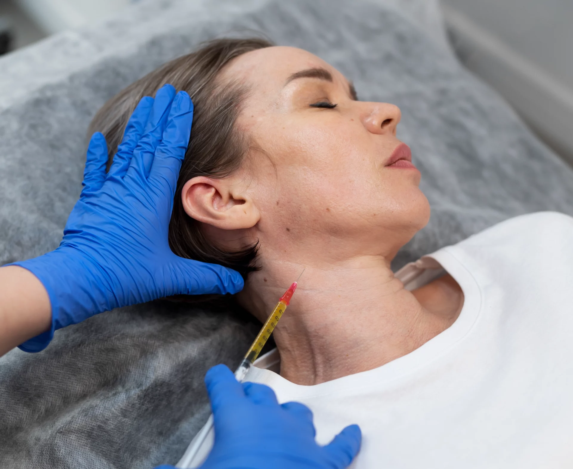 Lifting Cervicofacial Zabalegui