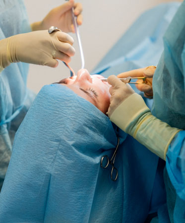 periodoncia bilbao